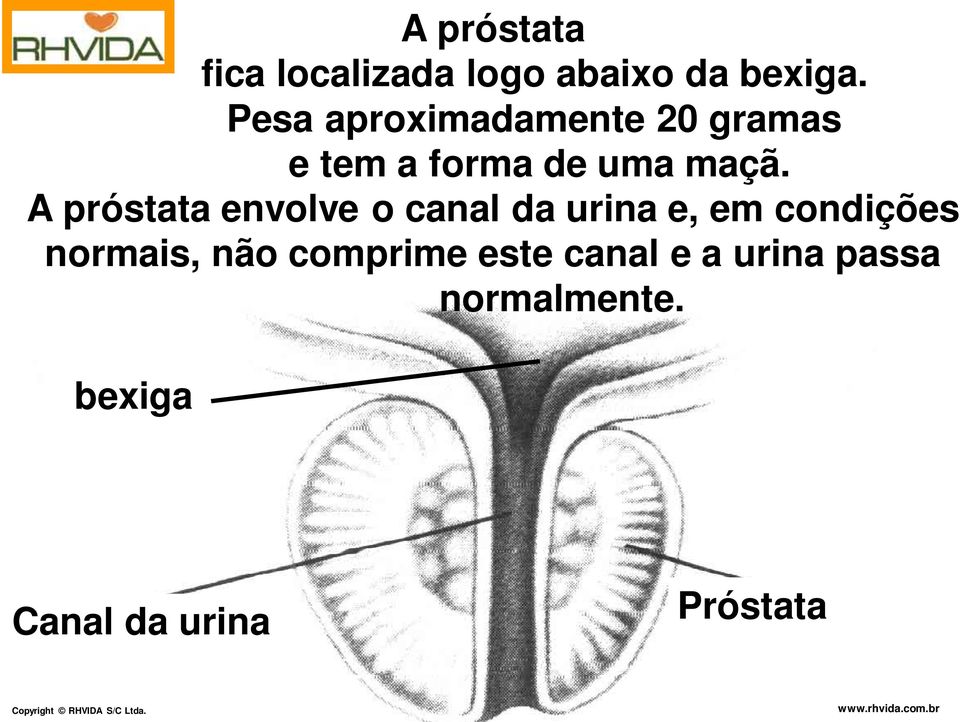 A próstata envolve o canal da urina e, em condições normais,