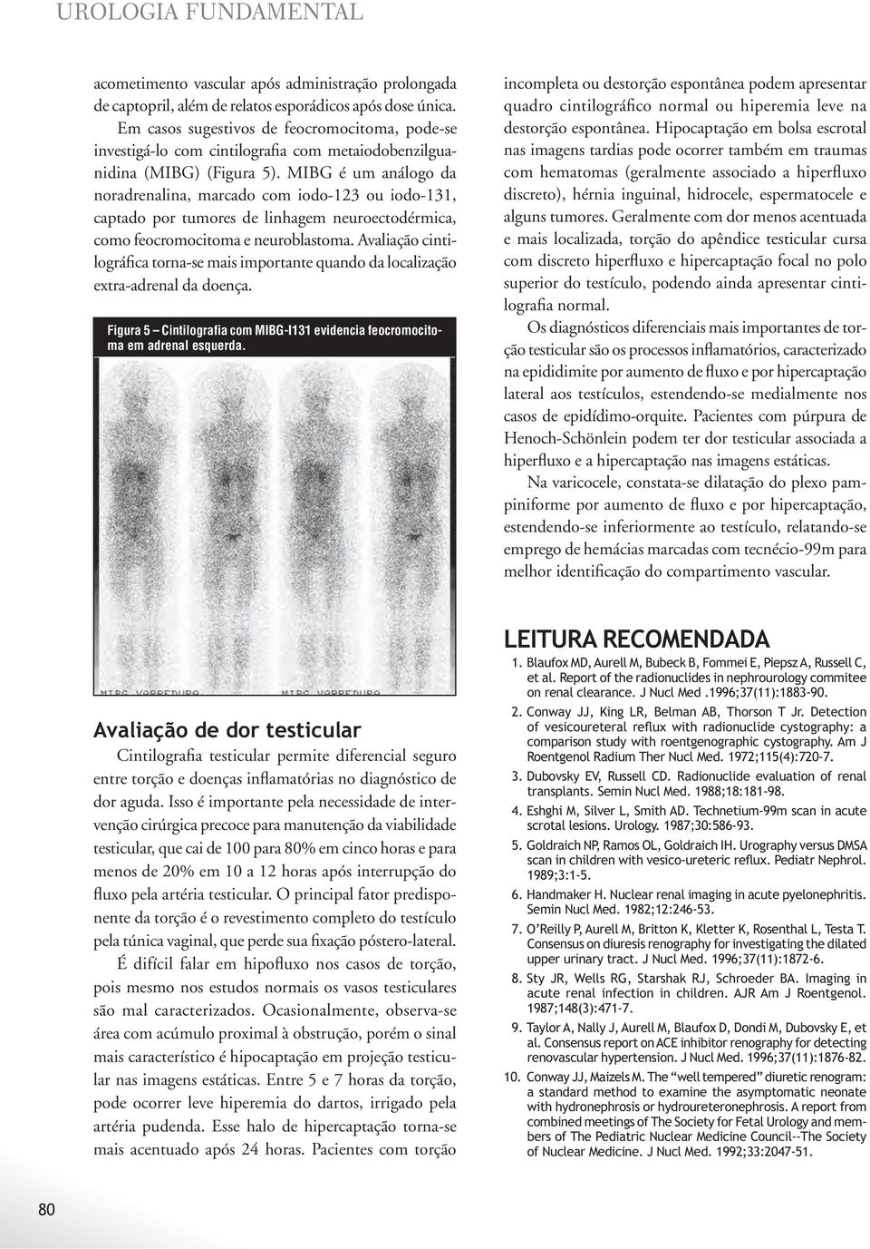 MIBG é um análogo da noradrenalina, marcado com iodo-123 ou iodo-131, captado por tumores de linhagem neuroectodérmica, como feocromocitoma e neuroblastoma.