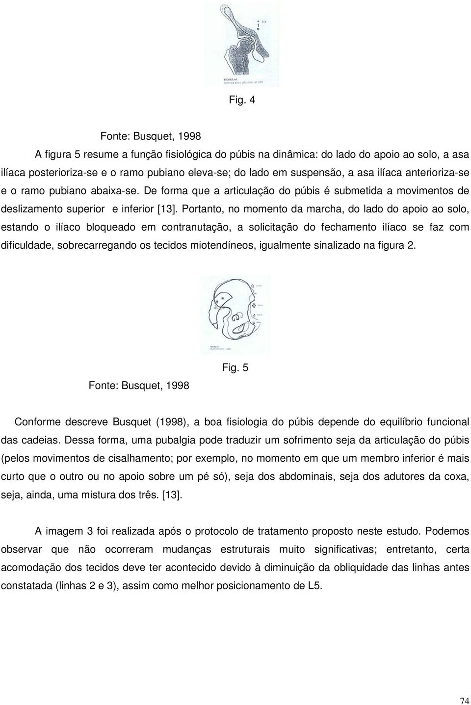 Portanto, no momento da marcha, do lado do apoio ao solo, estando o ilíaco bloqueado em contranutação, a solicitação do fechamento ilíaco se faz com dificuldade, sobrecarregando os tecidos