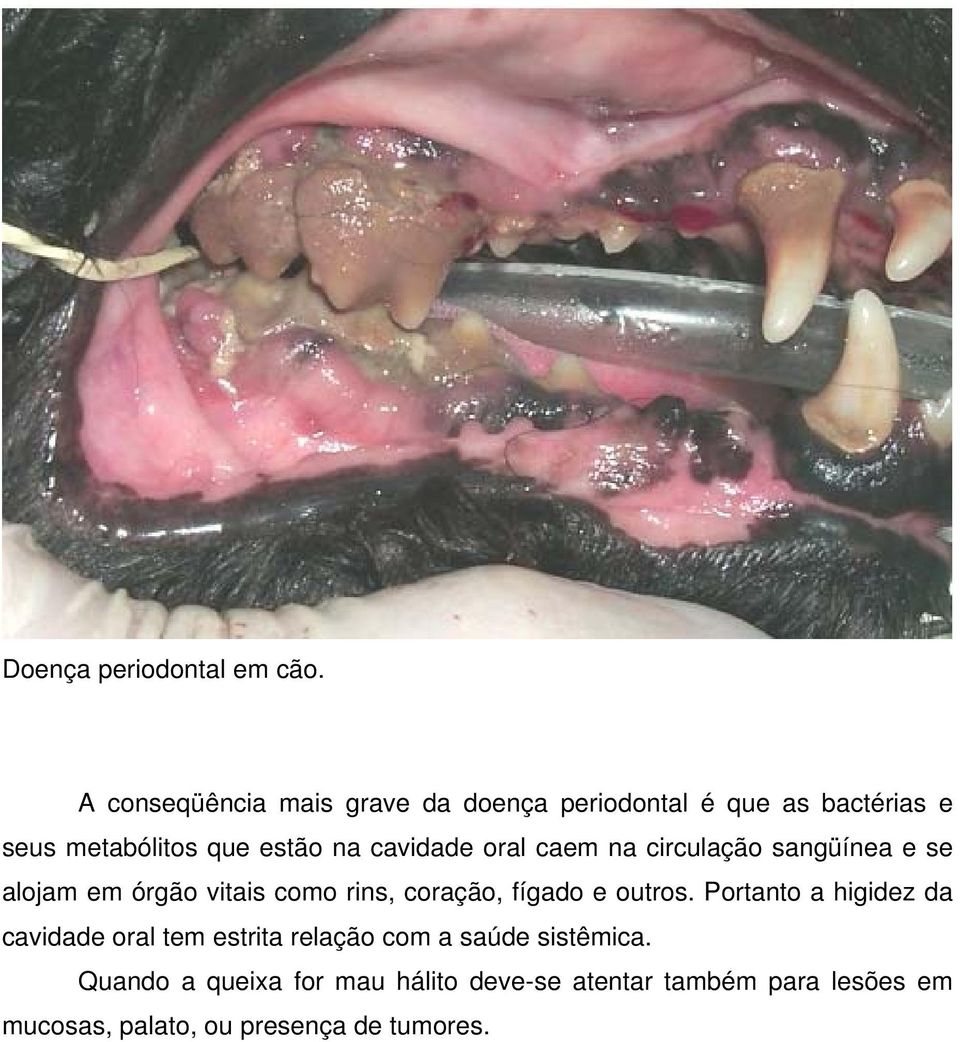 cavidade oral caem na circulação sangüínea e se alojam em órgão vitais como rins, coração, fígado e