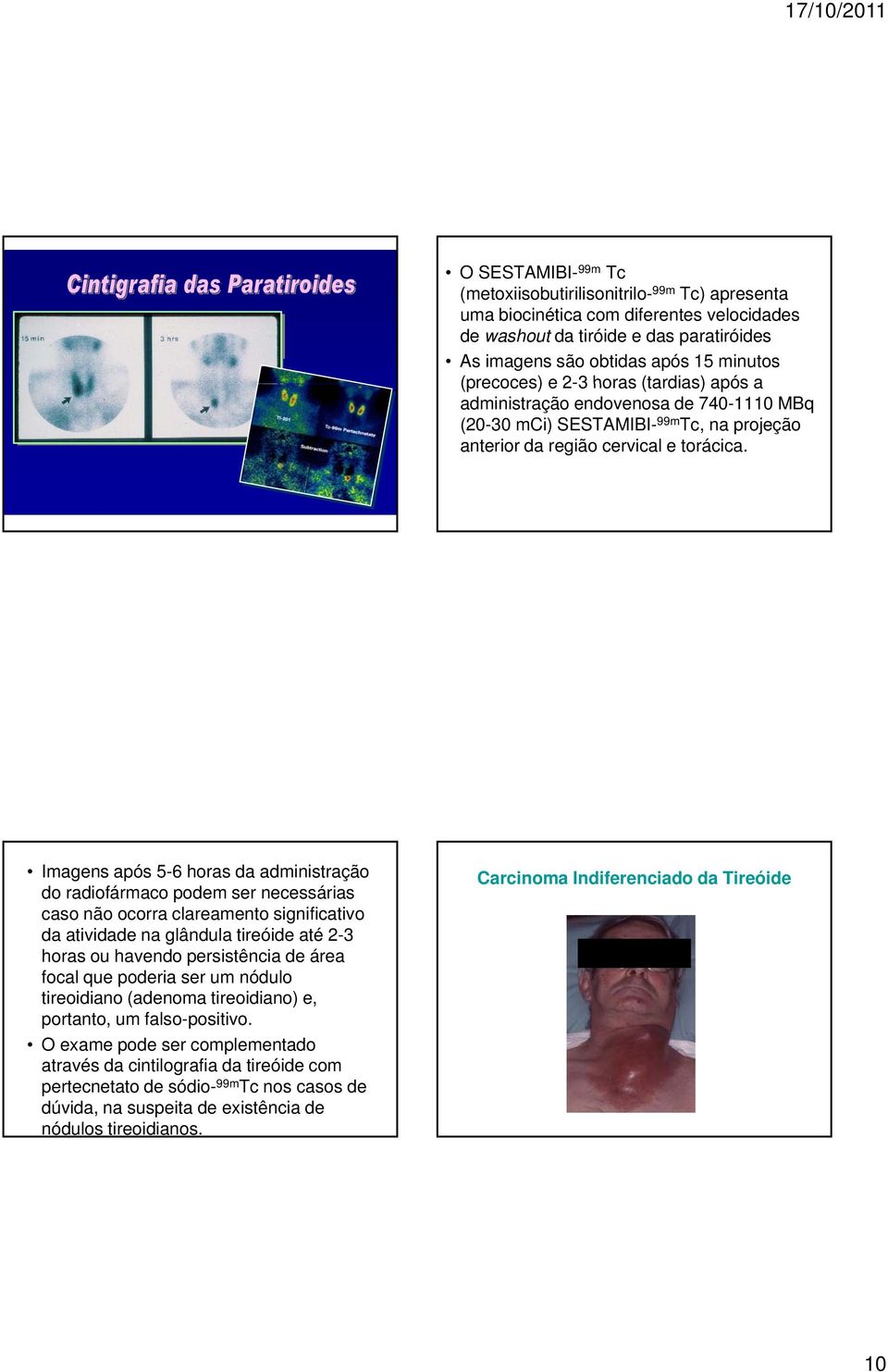 Imagens após 5-6 horas da administração do radiofármaco podem ser necessárias caso não ocorra clareamento significativo da atividade na glândula tireóide até 2-3 horas ou havendo persistência de área