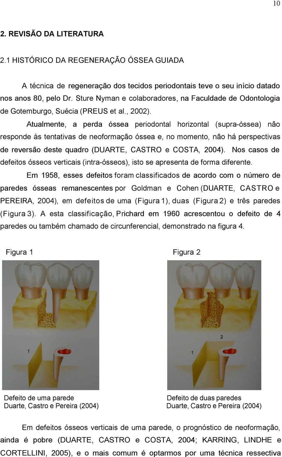 Atualmente, a perda óssea periodontal horizontal (supra-óssea) não responde às tentativas de neoformação óssea e, no momento, não há perspectivas de reversão deste quadro (DUARTE, CASTRO e COSTA,