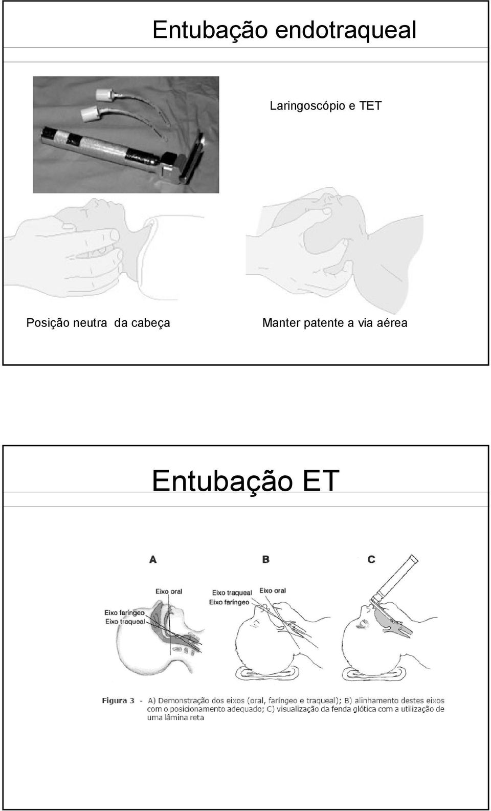 Posição neutra da cabeça