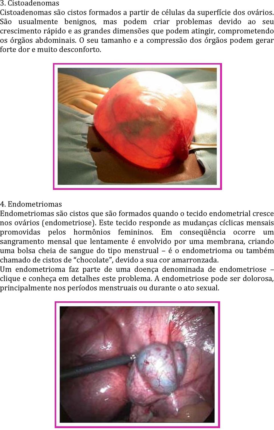 O seu tamanho e a compressão dos órgãos podem gerar forte dor e muito desconforto. 4.