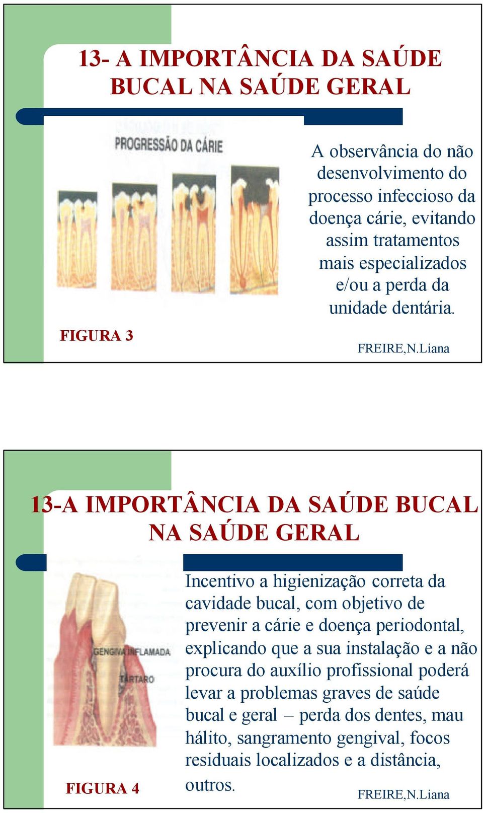 13-A IMPORTÂNCIA DA SAÚDE BUCAL NA SAÚDE GERAL FIGURA 4 Incentivo a higienização correta da cavidade bucal, com objetivo de prevenir a cárie e doença