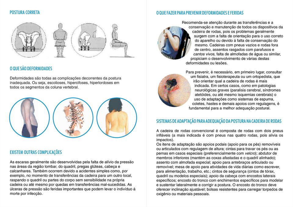 O QUE FAZER PARA PREVENIR DEFORMIDADES E FERIDAS Recomenda-se atenção durante as transferências e a conservação e manutenção de todos os dispositivos da cadeira de rodas, pois os problemas geralmente