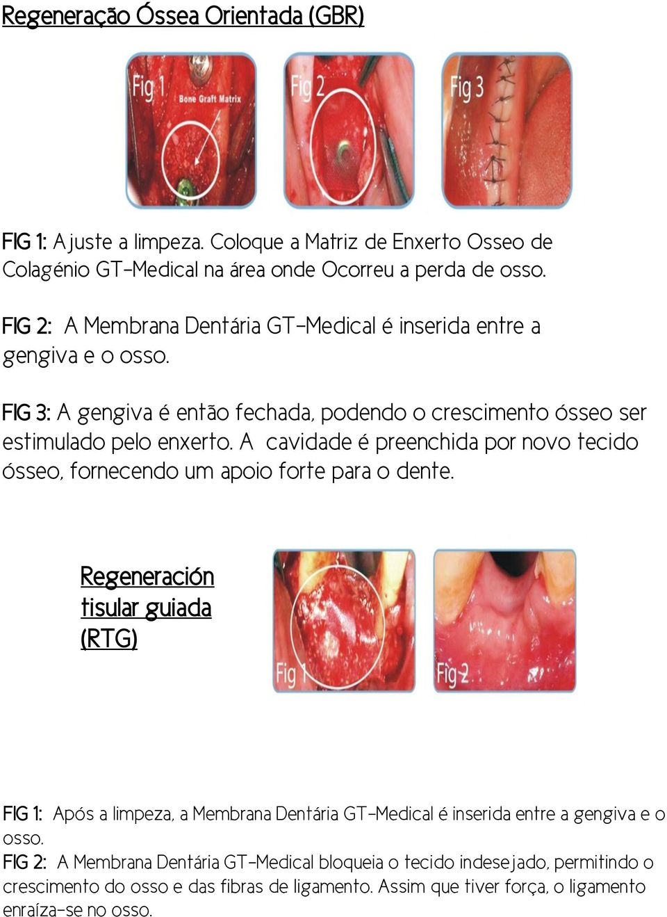 A cavidade é preenchida por novo tecido ósseo, fornecendo um apoio forte para o dente.