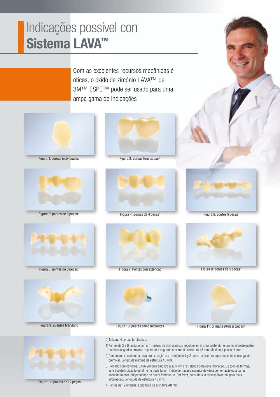 pontes de 4 peças 1 Figura 5: pontes 5 peças Figura 6: pontes de 6 peças 1 Figura 7: Pontes con extenção 2 Figura 8: pontes de 5 peças 1 Figura 9: puentes Maryland 3 Figura 10: pilares como implantes