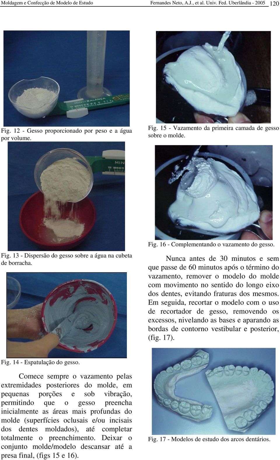 Nunca antes de 30 minutos e sem que passe de 60 minutos após o término do vazamento, remover o modelo do molde com movimento no sentido do longo eixo dos dentes, evitando fraturas dos mesmos.