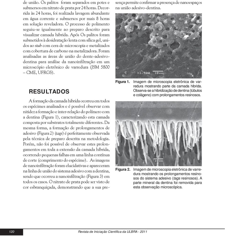 O processo de polimento seguiu-se igualmente ao preparo descrito para visualizar camada hibrida.