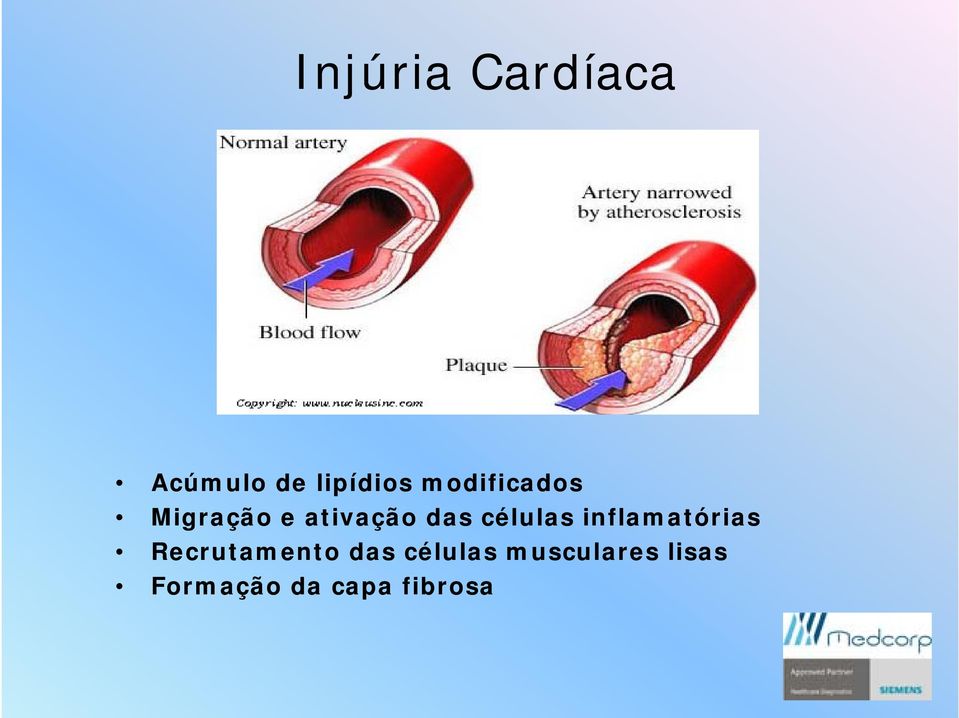 células inflamatórias Recrutamento das