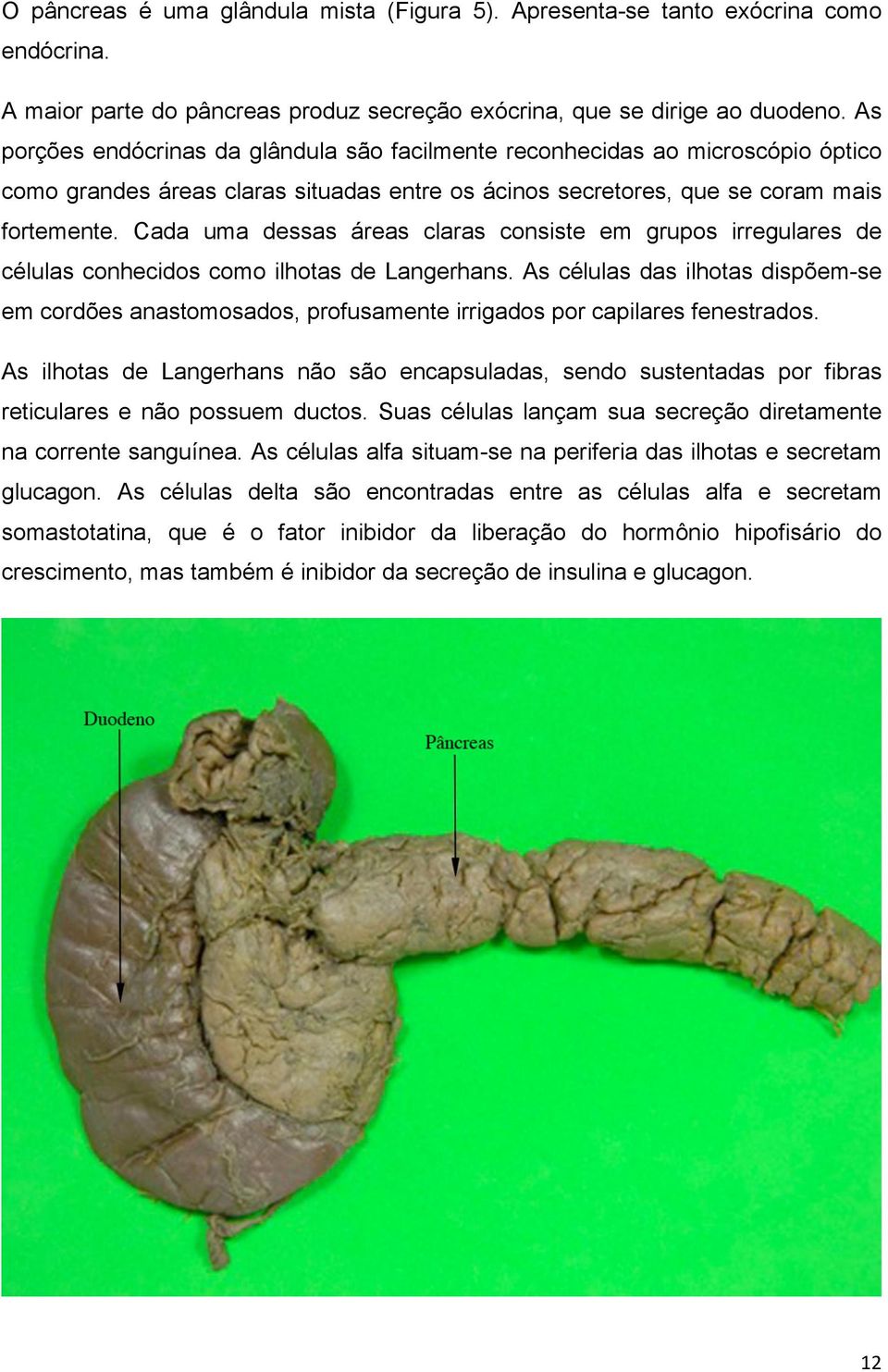 Cada uma dessas áreas claras consiste em grupos irregulares de células conhecidos como ilhotas de Langerhans.