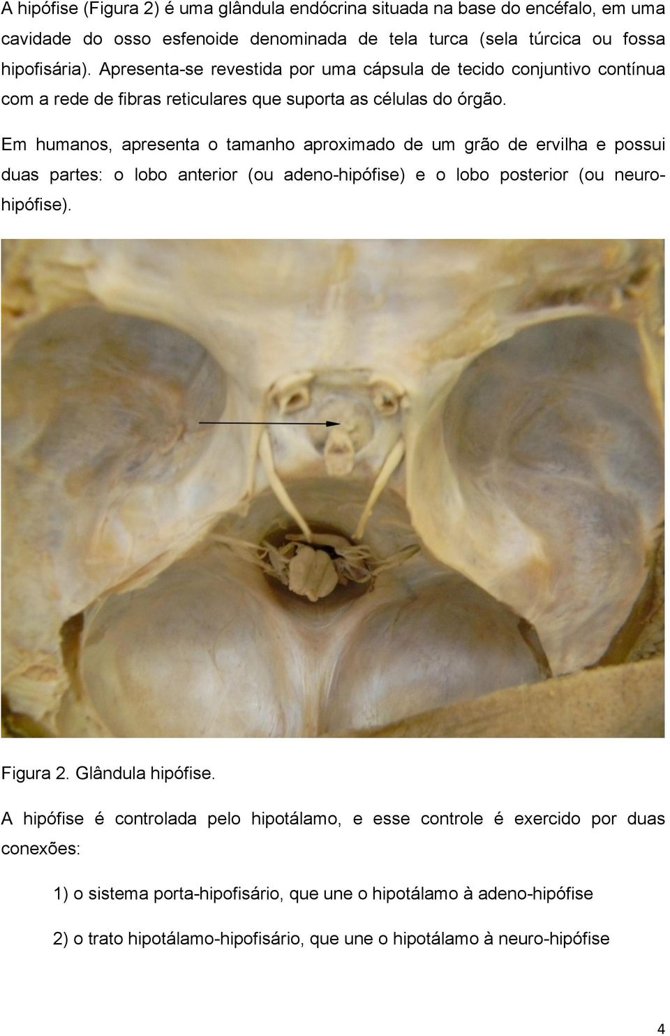 Em humanos, apresenta o tamanho aproximado de um grão de ervilha e possui duas partes: o lobo anterior (ou adeno-hipófise) e o lobo posterior (ou neurohipófise). Figura 2.