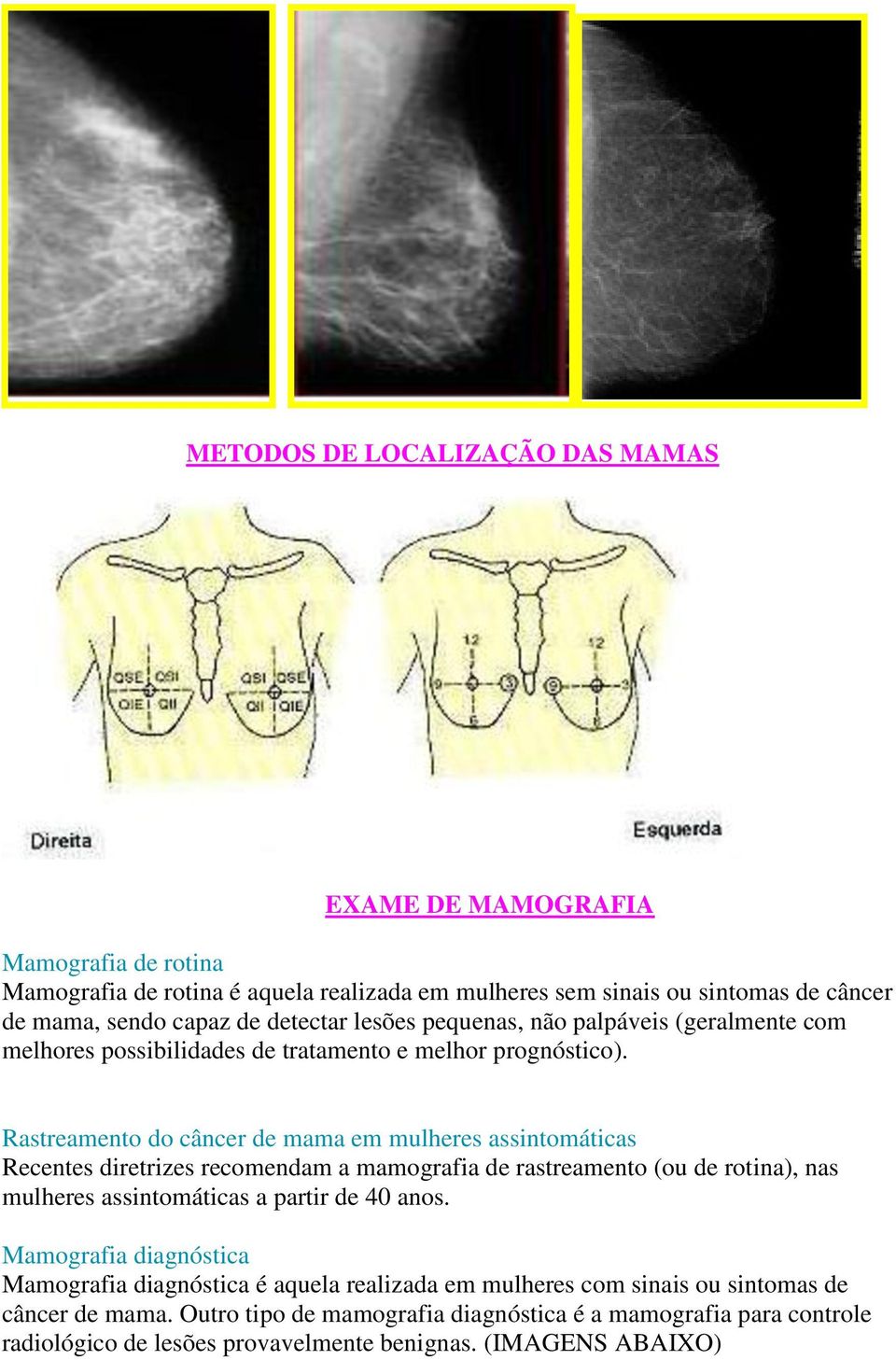 Rastreamento do câncer de mama em mulheres assintomáticas Recentes diretrizes recomendam a mamografia de rastreamento (ou de rotina), nas mulheres assintomáticas a partir de 40 anos.