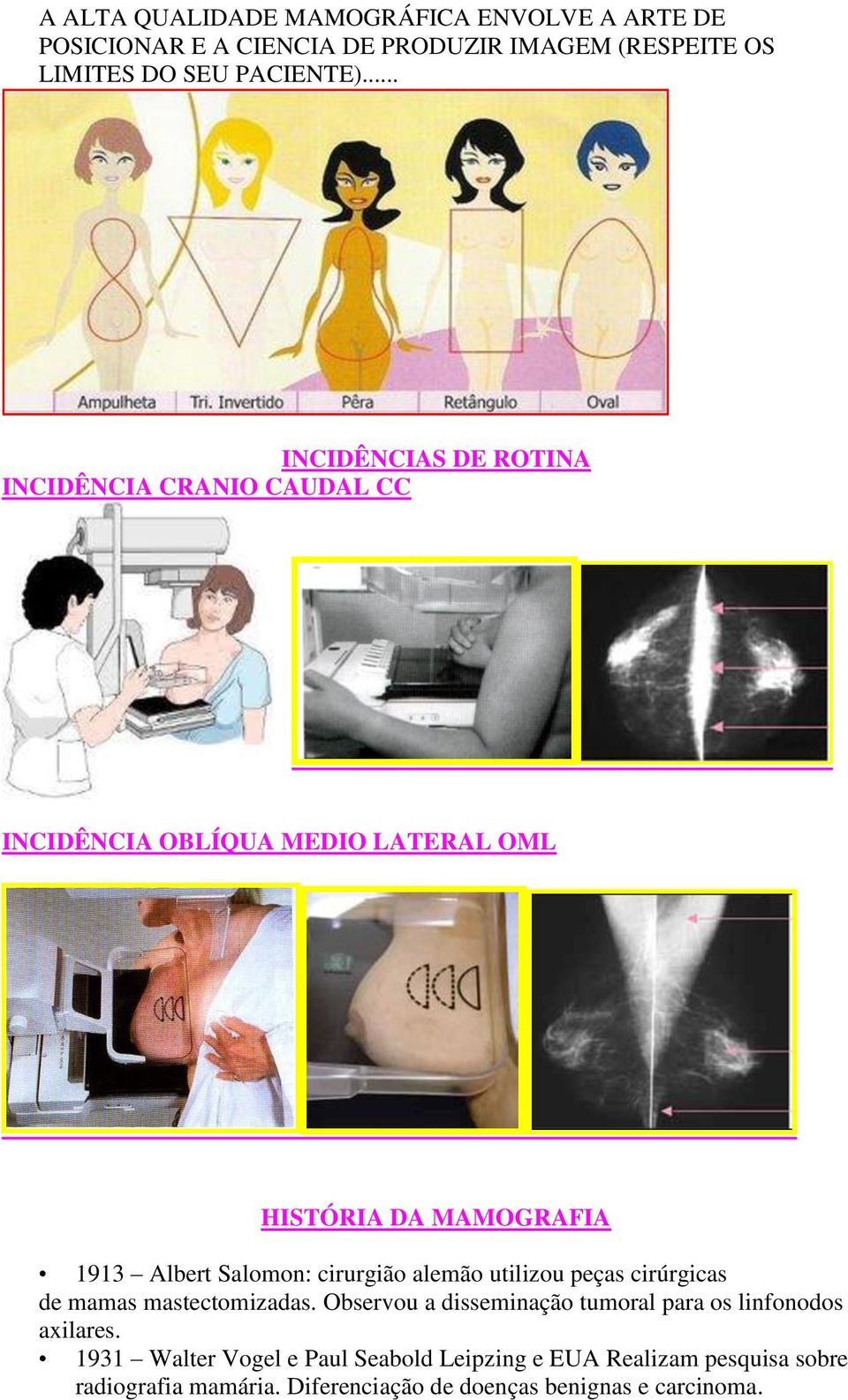 Salomon: cirurgião alemão utilizou peças cirúrgicas de mamas mastectomizadas.