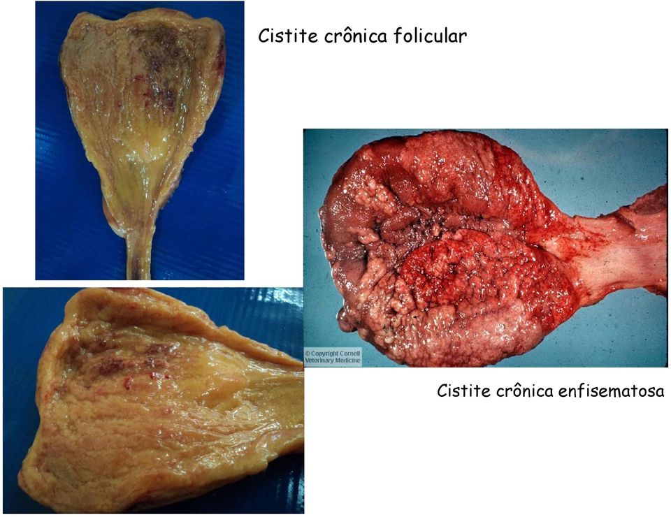 folicular  