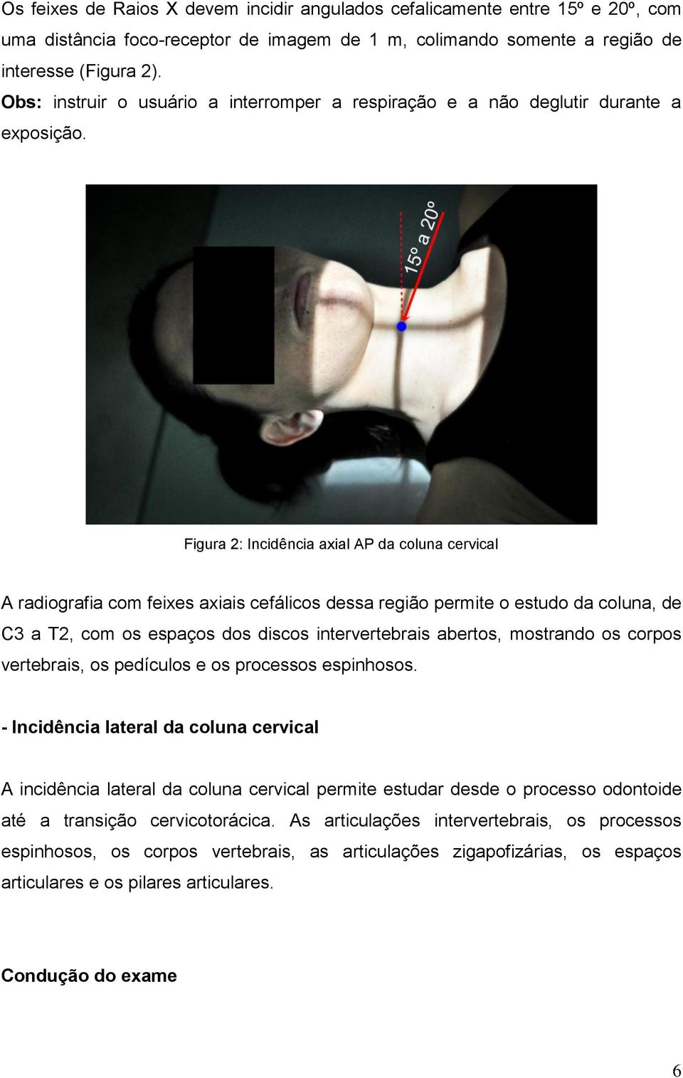 Figura 2: Incidência axial AP da coluna cervical A radiografia com feixes axiais cefálicos dessa região permite o estudo da coluna, de C3 a T2, com os espaços dos discos intervertebrais abertos,