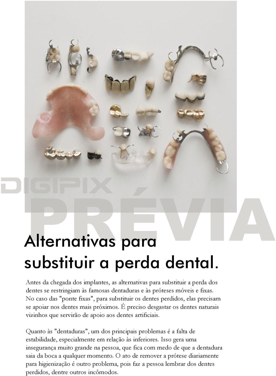 É preciso desgastar os dentes naturais vizinhos que servirão de apoio aos dentes artificiais.