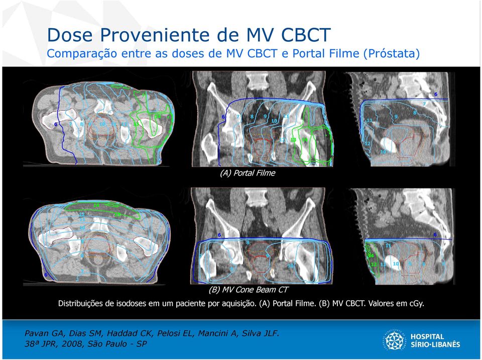 9 8 7 (B) MV Cone Beam CT Distribuições de isodoses em um paciente por aquisição. (A) Portal Filme. (B) MV CBCT.