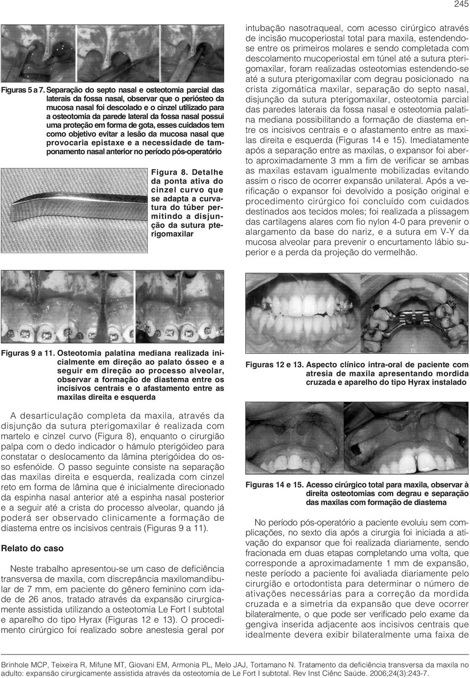 nasal possui uma proteção em forma de gota, esses cuidados tem como objetivo evitar a lesão da mucosa nasal que provocaria epistaxe e a necessidade de tamponamento nasal anterior no período