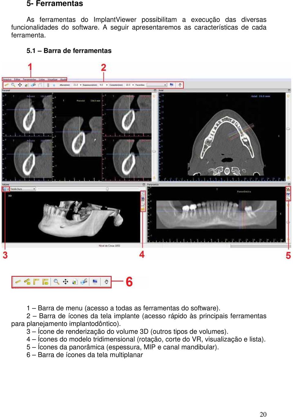 2 Barra de ícones da tela implante (acesso rápido às principais ferramentas para planejamento implantodôntico).