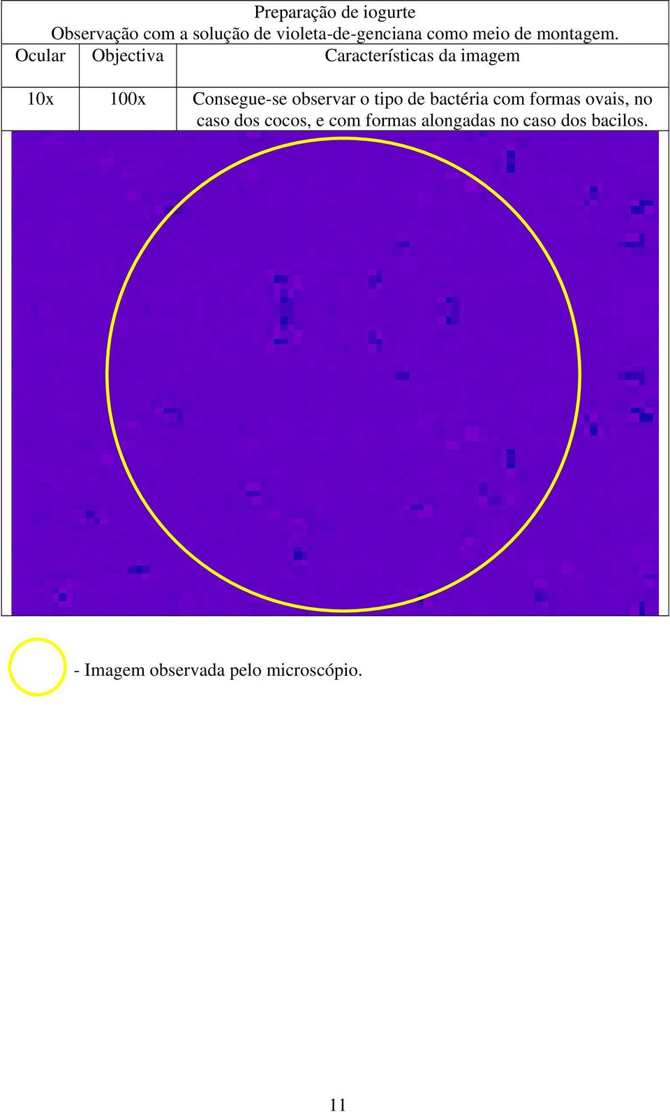 10x 100x Consegue-se observar o tipo de bactéria com