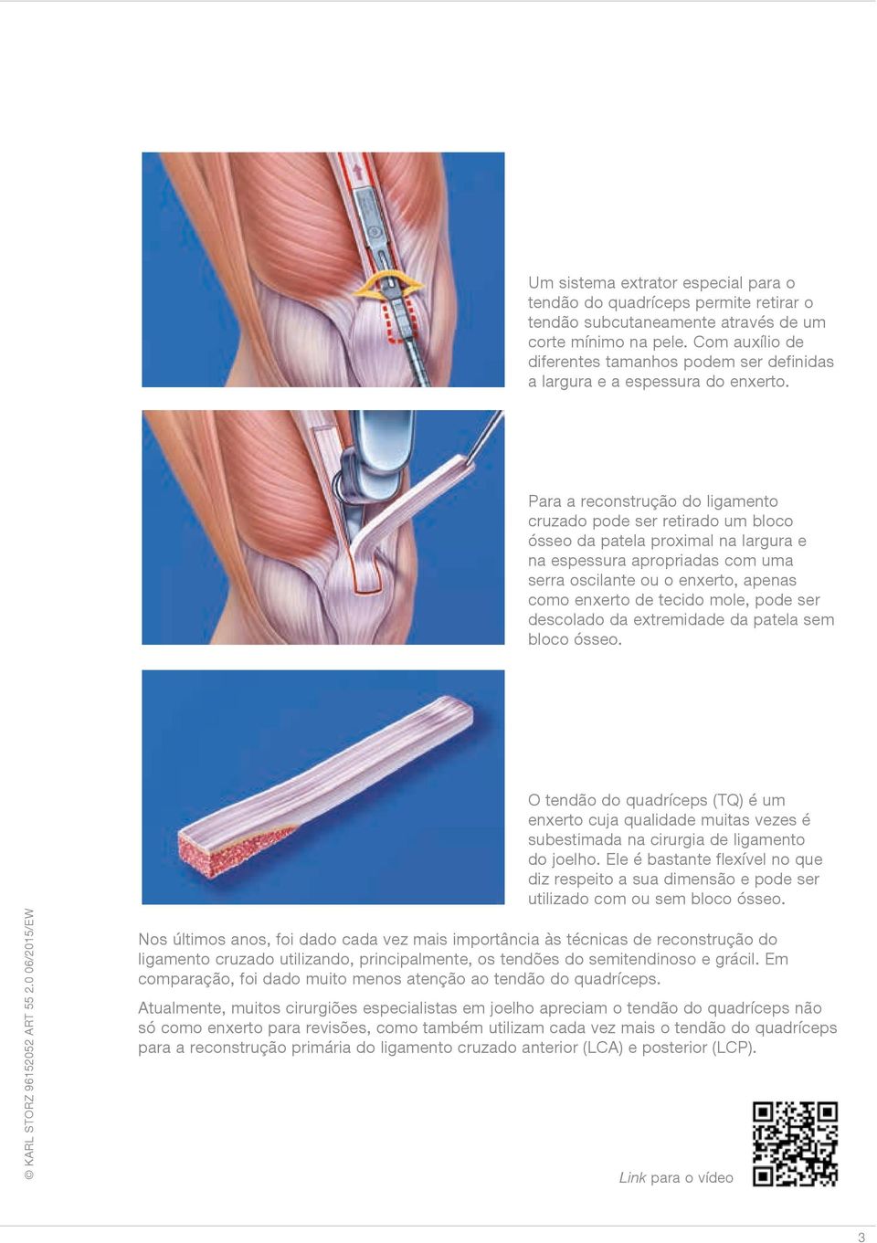 Para a reconstrução do ligamento cruzado pode ser retirado um bloco ósseo da patela proximal na largura e na espessura apropriadas com uma serra oscilante ou o enxerto, apenas como enxerto de tecido