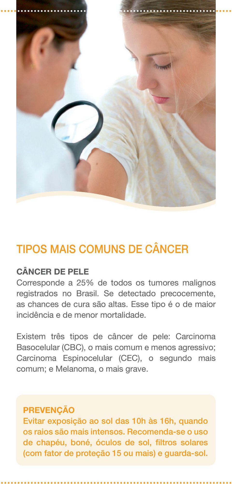 Existem três tipos de câncer de pele: Carcinoma Basocelular (CBC), o mais comum e menos agressivo; Carcinoma Espinocelular (CEC), o segundo mais comum;