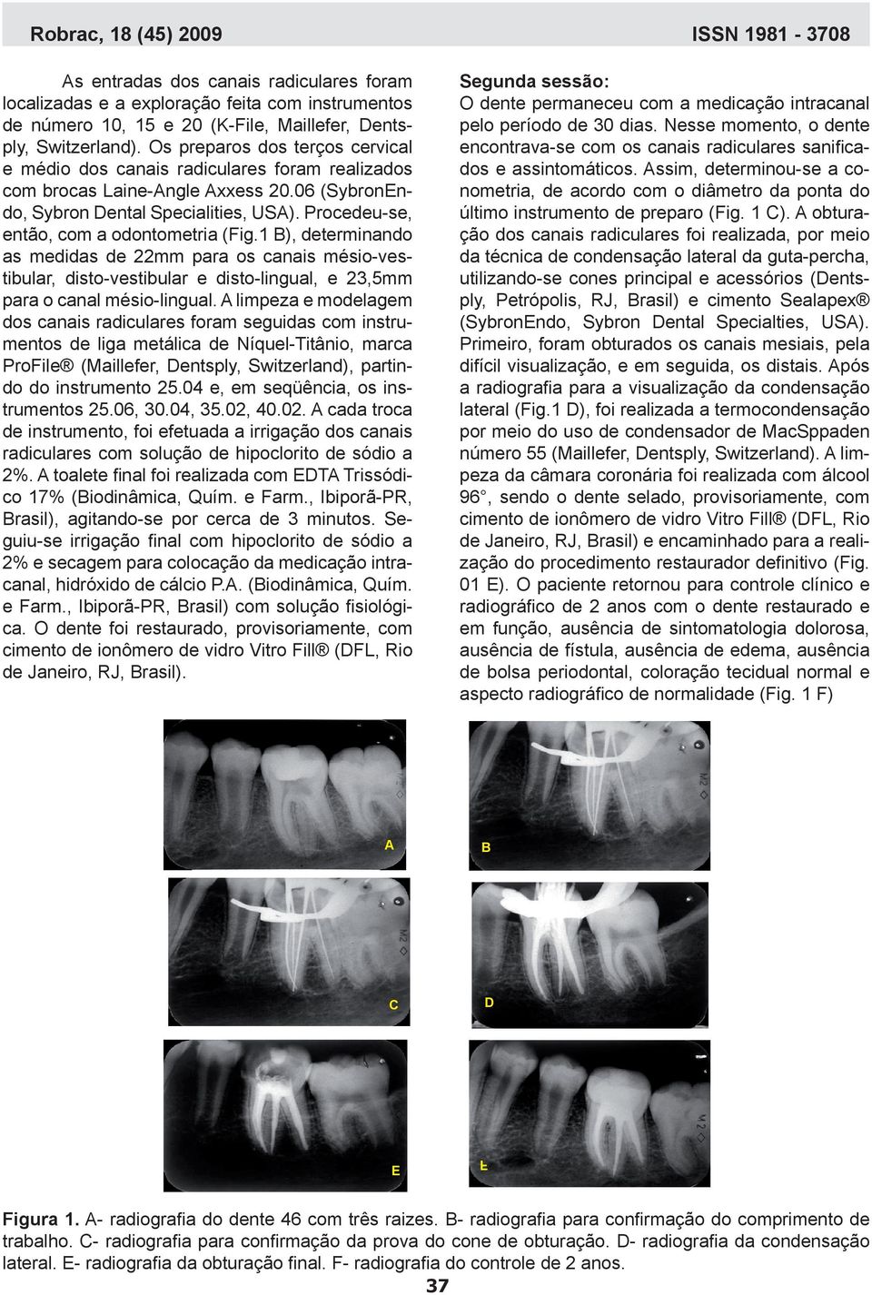 Procedeu-se, então, com a odontometria (Fig.1 B), determinando as medidas de 22mm para os canais mésio-vestibular, disto-vestibular e disto-lingual, e 23,5mm para o canal mésio-lingual.