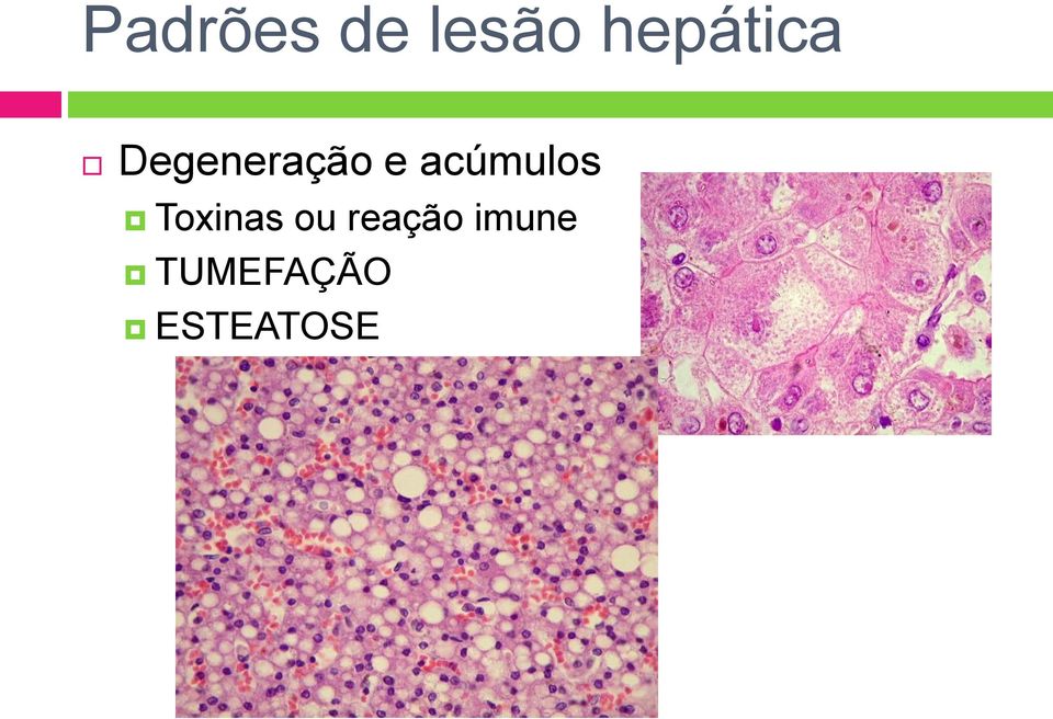 acúmulos Toxinas ou