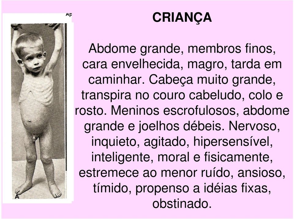 Meninos escrofulosos, abdome grande e joelhos débeis.