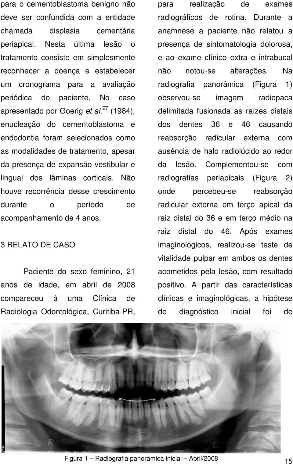 27 (1984), enucleação do cementoblastoma e endodontia foram selecionados como as modalidades de tratamento, apesar da presença de expansão vestibular e lingual dos lâminas corticais.