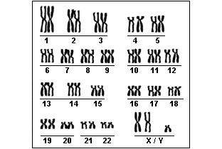 6. O esquema ao lado mostra as sequências do DNA que levam à formação da hemoglobina normal e à formação da hemoglobina alterada.