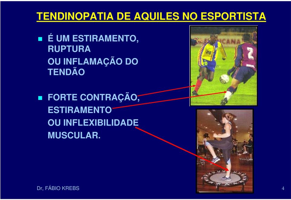 CONTRAÇÃO, ESTIRAMENTO OU