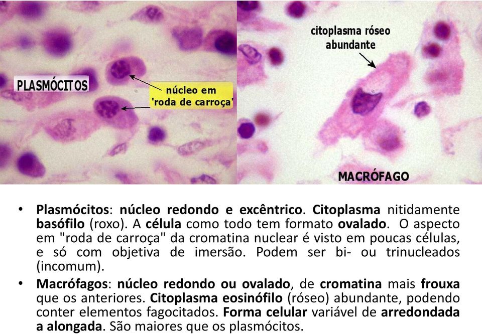 Podem ser bi- ou trinucleados (incomum). Macrófagos: núcleo redondo ou ovalado, de cromatina mais frouxa que os anteriores.