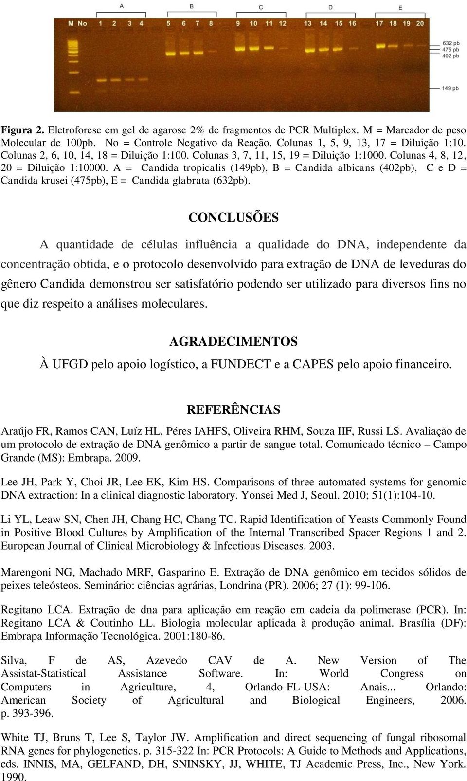 A = Candida tropicalis (149pb), B = Candida albicans (402pb), C e D = Candida krusei (475pb), E = Candida glabrata (632pb).