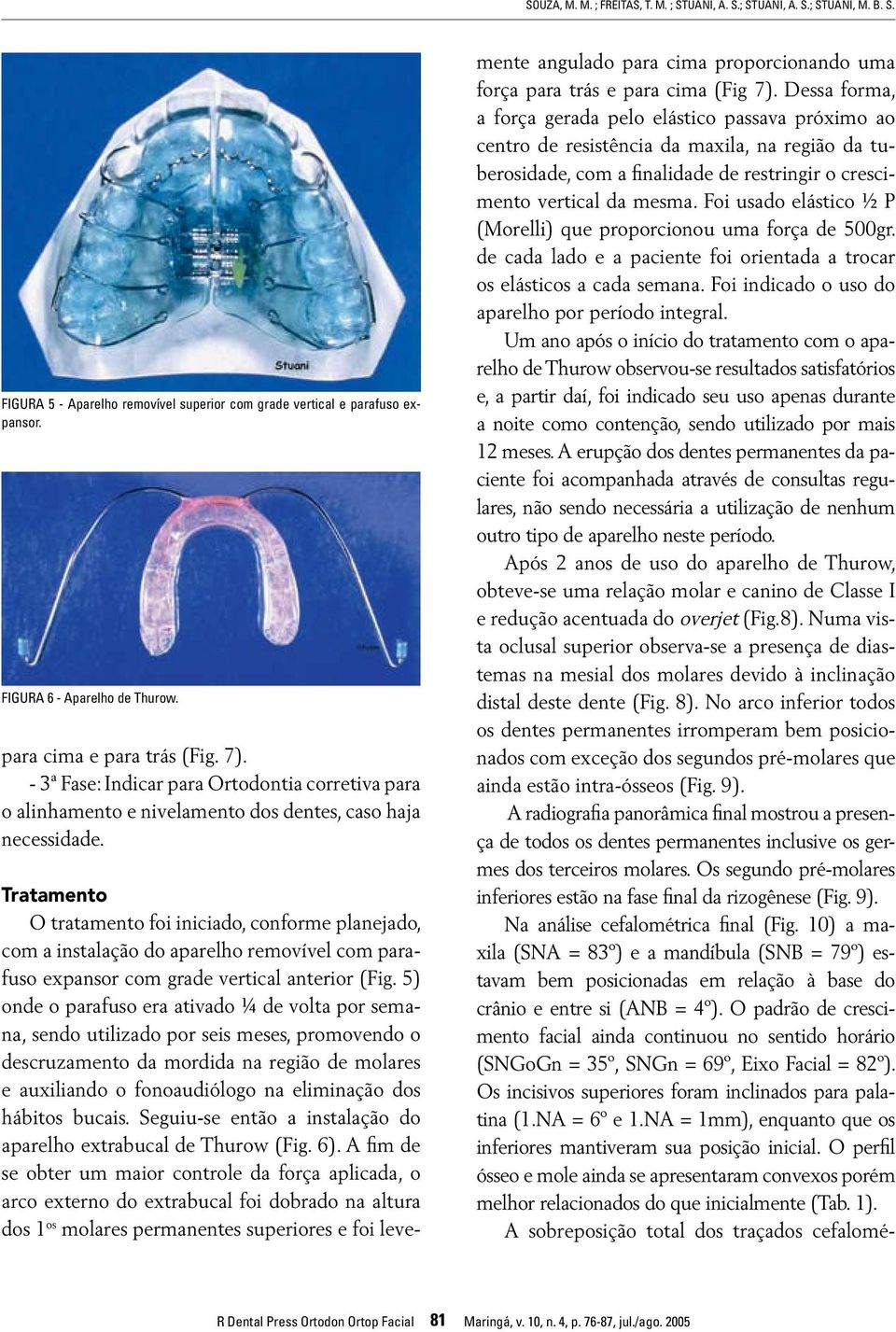 Tratamento O tratamento foi iniciado, conforme planejado, com a instalação do aparelho removível com parafuso expansor com grade vertical anterior (Fig.