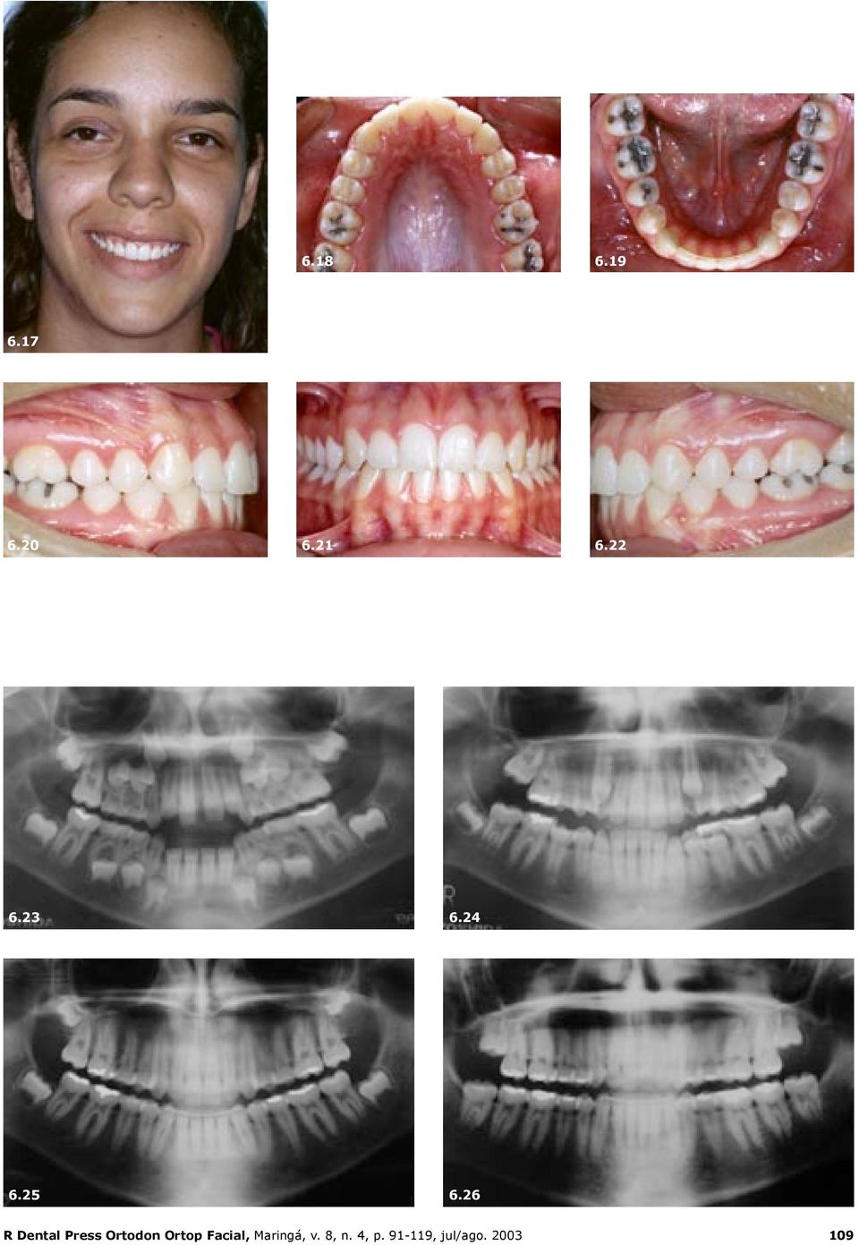 26 R Dental Press Ortodon Ortop