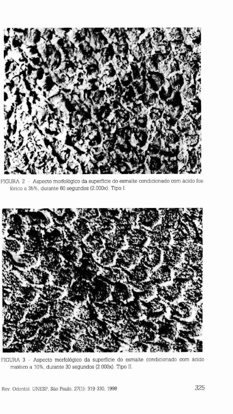 FIGURA 3 - Aspecto morfológico da superfície do esmalte condicionado com ácido