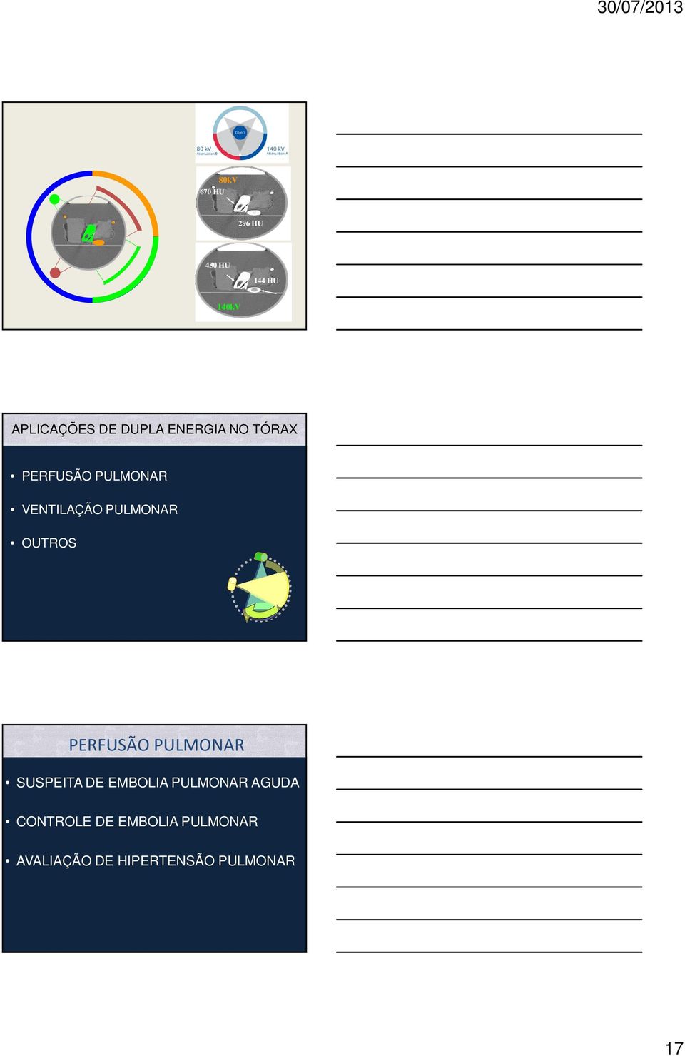 Clinical PERFUSÃO Background PULMONAR and SUSPEITA DE EMBOLIA