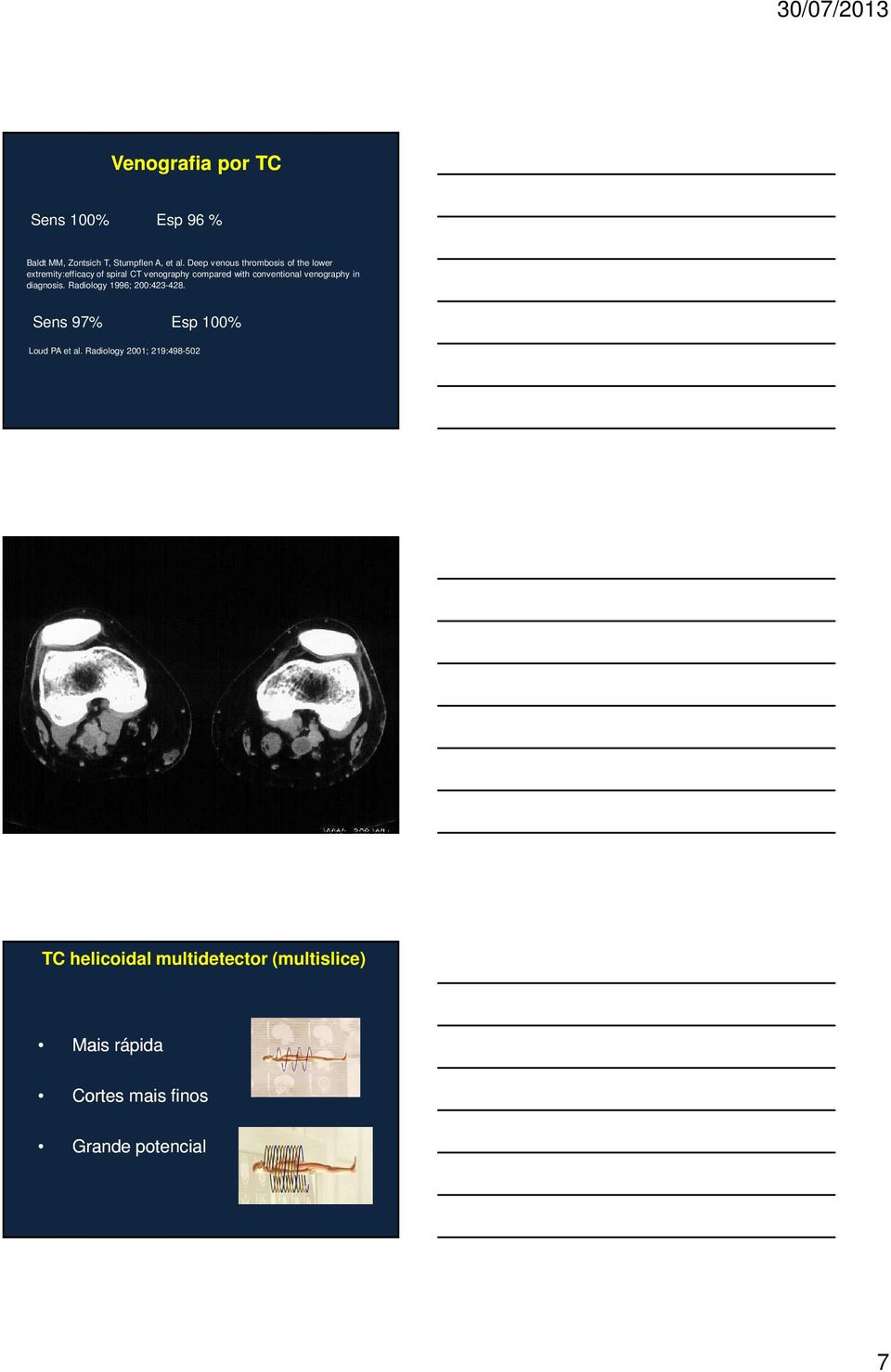 conventional venography in diagnosis. Radiology 1996; 200:423-428.