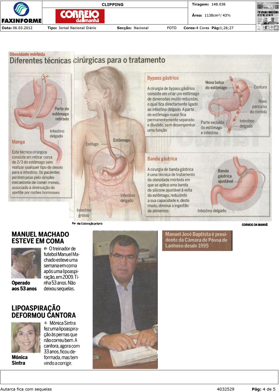 Segundo o especialista, pioneiro nesta técnica cirúrgica em Portugal, o risco de infecção da ban - da gástrica pode ocorrer, "mas é raro".