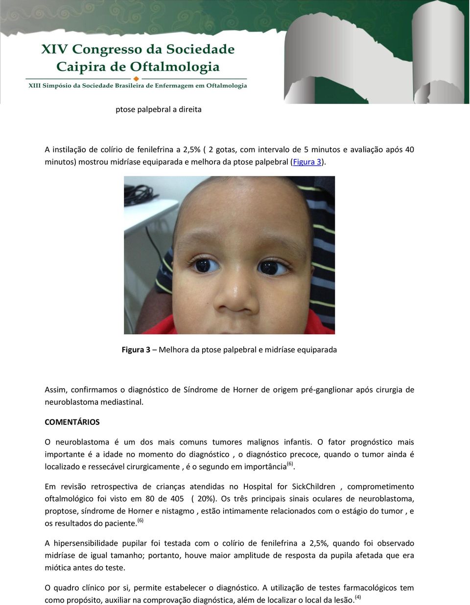 COMENTÁRIOS O neuroblastoma é um dos mais comuns tumores malignos infantis.