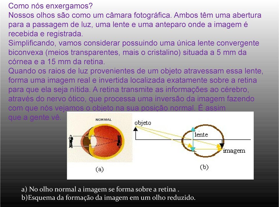 Quando os raios de luz provenientes de um objeto atravessam essa lente, forma uma imagem real e invertida localizada exatamente sobre a retina para que ela seja nítida.