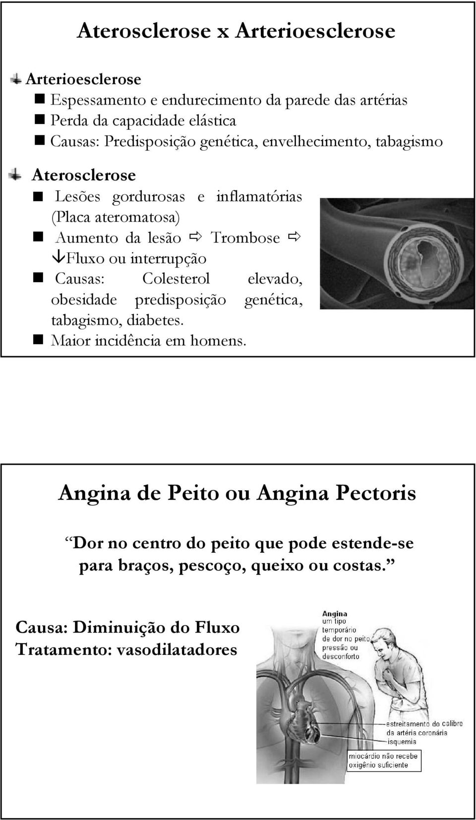 Fluxo ou interrupção Causas: Colesterol elevado, obesidade predisposição genética, tabagismo, diabetes. Maior incidência em homens.