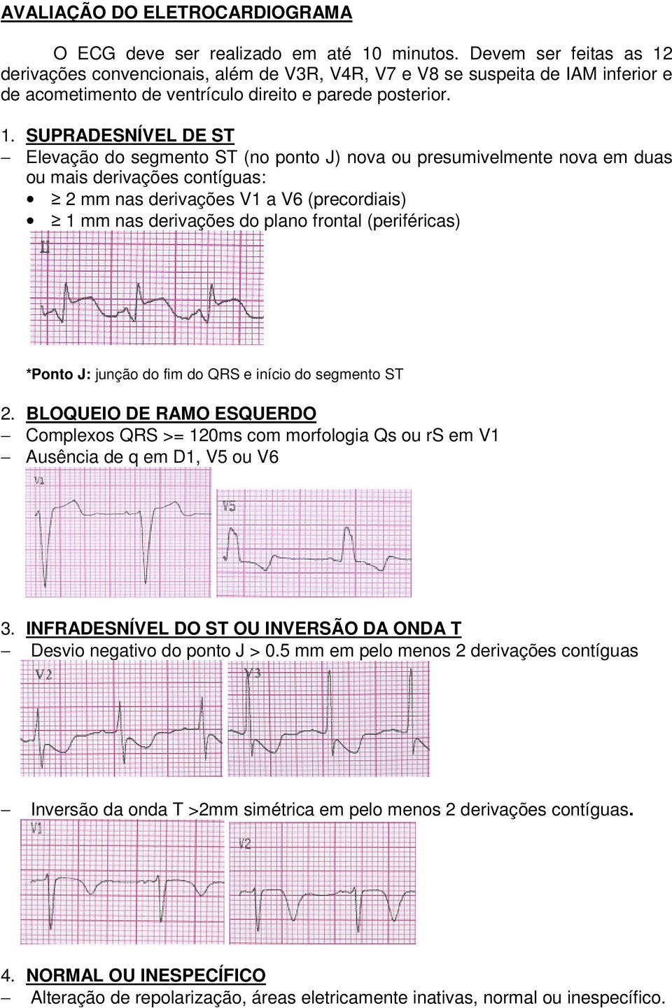 derivações convencionais, além de V3R, V4R, V7 e V8 se suspeita de IAM inferior e de acometimento de ventrículo direito e parede posterior. 1.