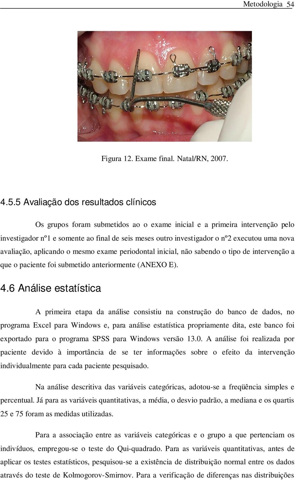 5 Avaliação dos resultados clínicos Os grupos foram submetidos ao o exame inicial e a primeira intervenção pelo investigador nº1 e somente ao final de seis meses outro investigador o nº2 executou uma