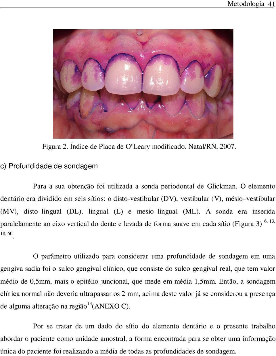 A sonda era inserida paralelamente ao eixo vertical do dente e levada de forma suave em cada sítio (Figura 3) 18, 60.