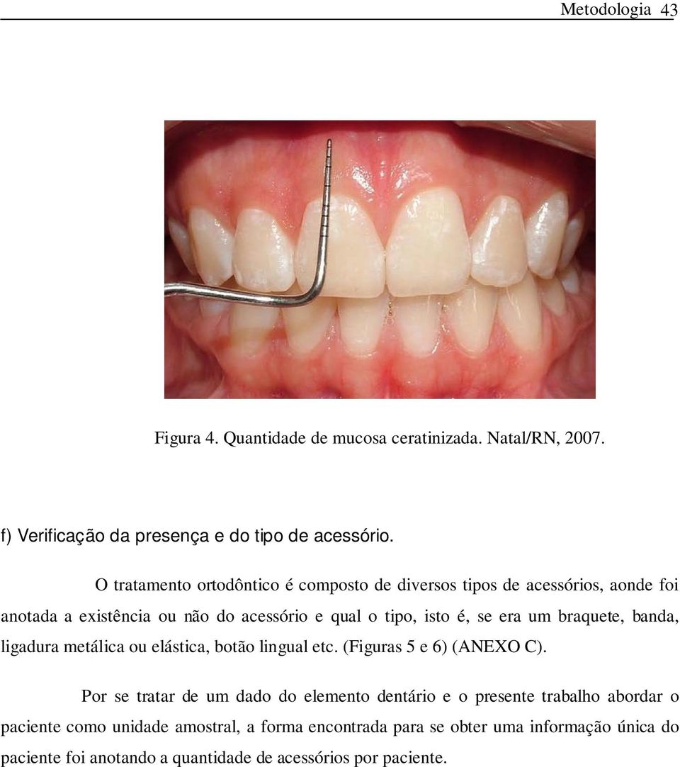 um braquete, banda, ligadura metálica ou elástica, botão lingual etc. (Figuras 5 e 6) (ANEXO C).