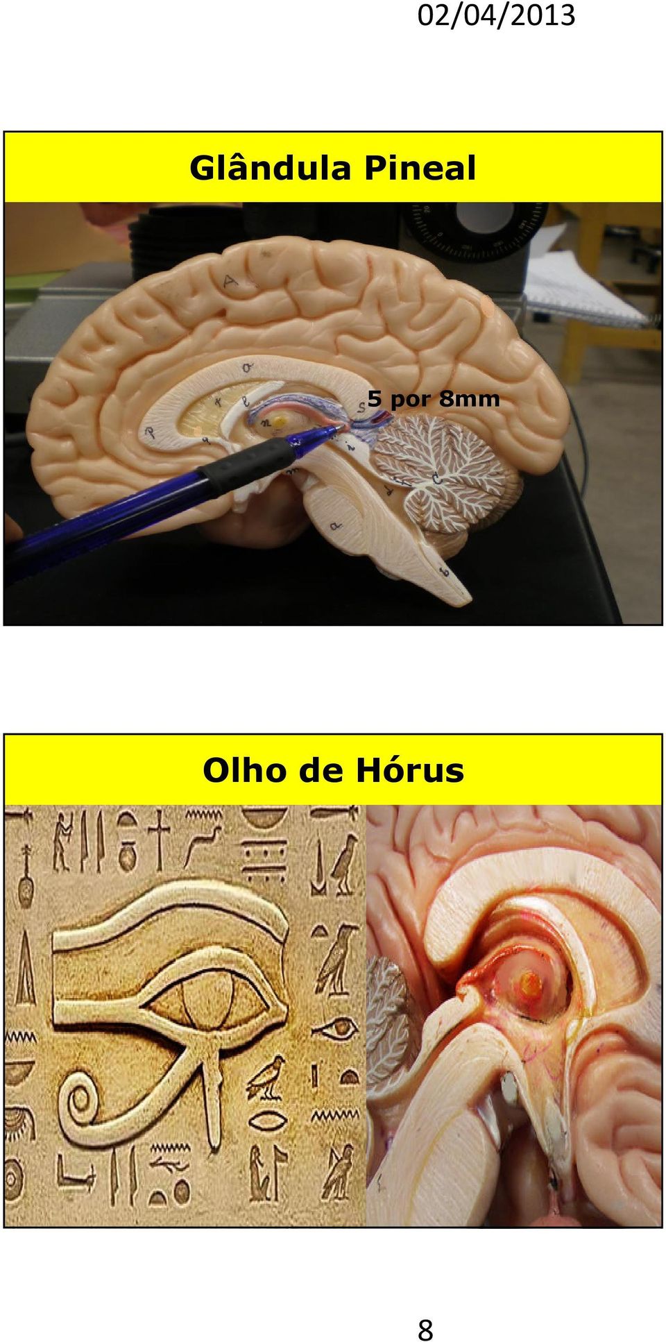 Colículo Inferior Glândula Pituitária Ponte Vista